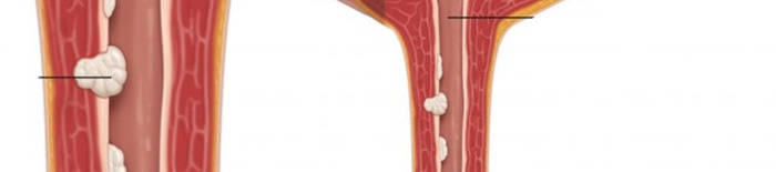 desmesothelialenGewebes1.jpg
