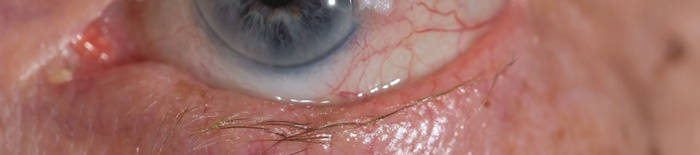 desmesothelialenGewebes1.jpg