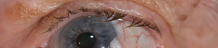 desmesothelialenGewebes1.jpg