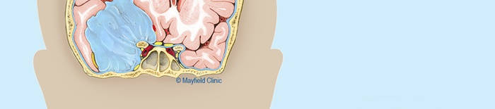 desmesothelialenGewebes1.jpg