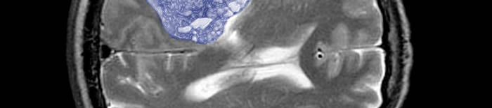 desmesothelialenGewebes1.jpg