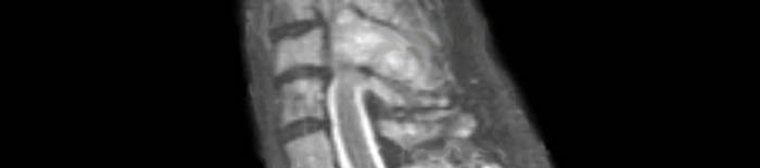 desmesothelialenGewebes1.jpg