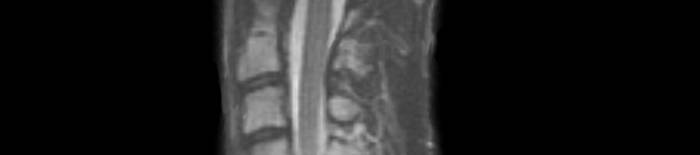 desmesothelialenGewebes1.jpg