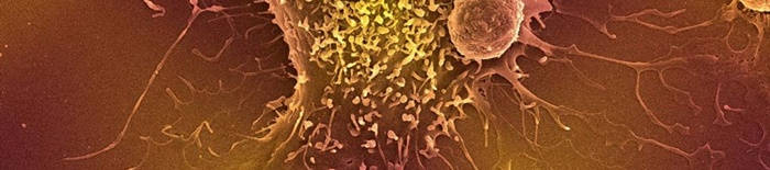 desmesothelialenGewebes1.jpg