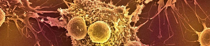 desmesothelialenGewebes1.jpg