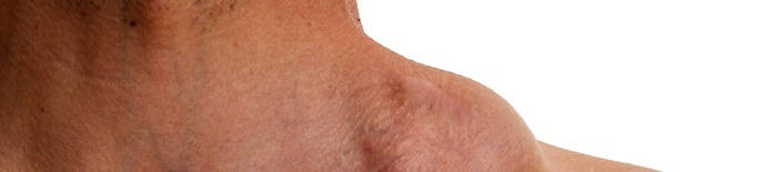 desmesothelialenGewebes1.jpg