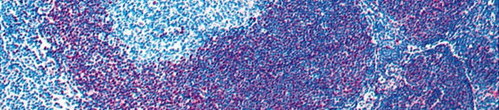 desmesothelialenGewebes1.jpg