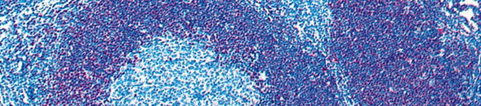 desmesothelialenGewebes1.jpg
