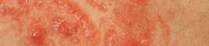 desmesothelialenGewebes1.jpg