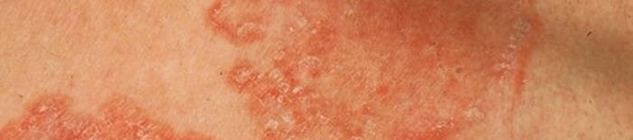 desmesothelialenGewebes1.jpg