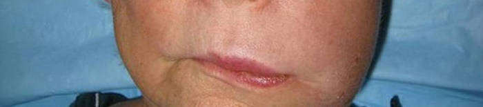 desmesothelialenGewebes1.jpg