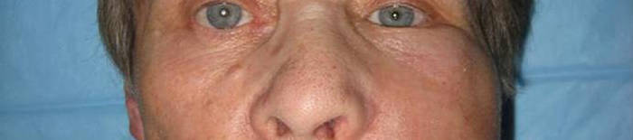 desmesothelialenGewebes1.jpg