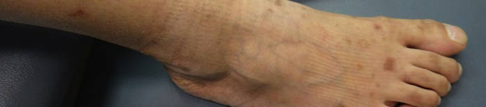 desmesothelialenGewebes1.jpg