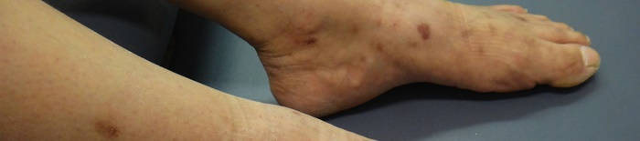 desmesothelialenGewebes1.jpg
