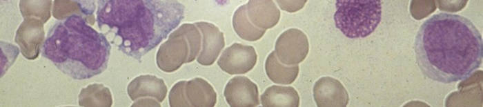 desmesothelialenGewebes1.jpg