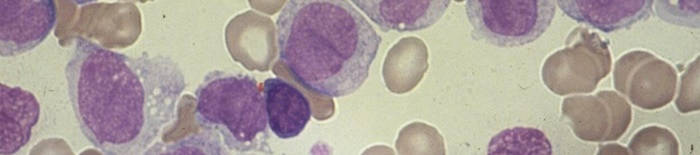 desmesothelialenGewebes1.jpg