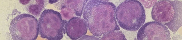desmesothelialenGewebes1.jpg