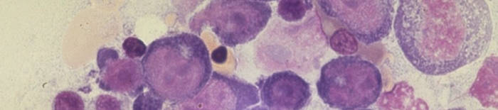 desmesothelialenGewebes1.jpg