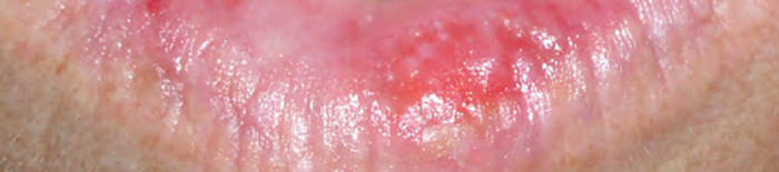 desmesothelialenGewebes1.jpg
