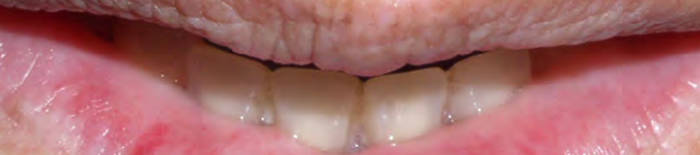 desmesothelialenGewebes1.jpg