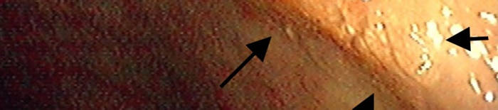 desmesothelialenGewebes1.jpg