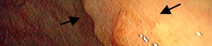 desmesothelialenGewebes1.jpg