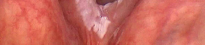 desmesothelialenGewebes1.jpg