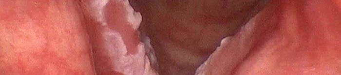 desmesothelialenGewebes1.jpg