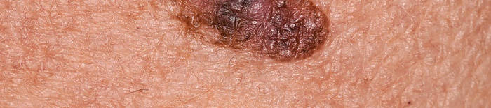 desmesothelialenGewebes1.jpg
