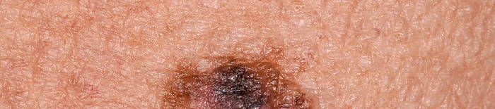 desmesothelialenGewebes1.jpg