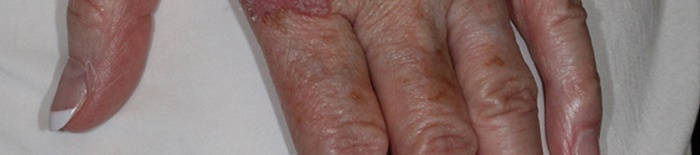 desmesothelialenGewebes1.jpg