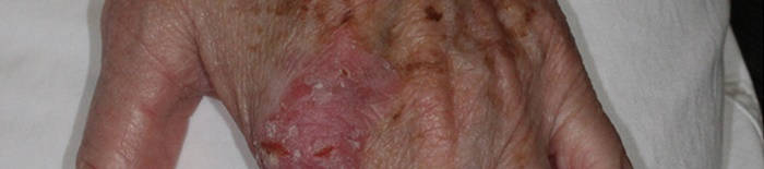 desmesothelialenGewebes1.jpg