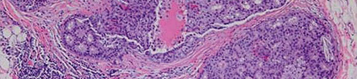 desmesothelialenGewebes1.jpg