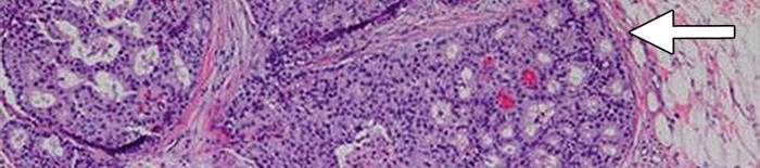 desmesothelialenGewebes1.jpg