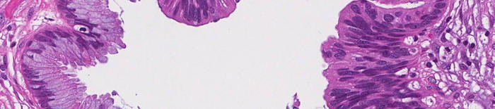 desmesothelialenGewebes1.jpg