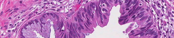 desmesothelialenGewebes1.jpg
