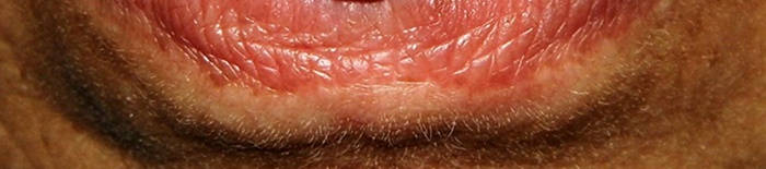 desmesothelialenGewebes1.jpg