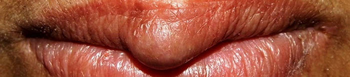desmesothelialenGewebes1.jpg
