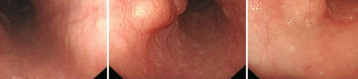 desmesothelialenGewebes1.jpg