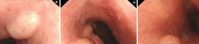 desmesothelialenGewebes1.jpg