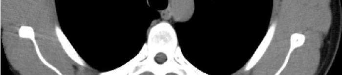 desmesothelialenGewebes1.jpg