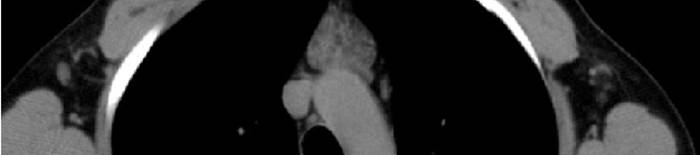 desmesothelialenGewebes1.jpg