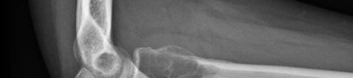 desmesothelialenGewebes1.jpg