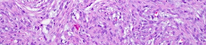 desmesothelialenGewebes1.jpg