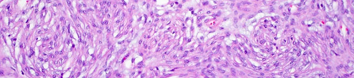 desmesothelialenGewebes1.jpg