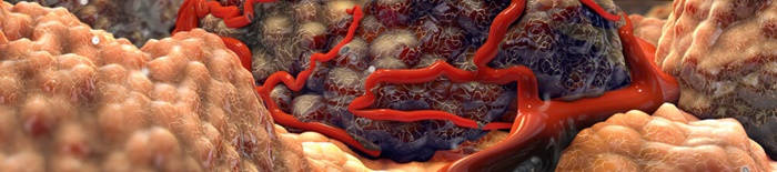 desmesothelialenGewebes1.jpg