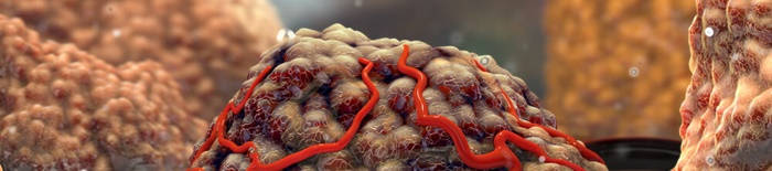 desmesothelialenGewebes1.jpg