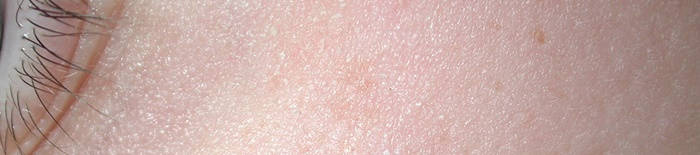 desmesothelialenGewebes1.jpg