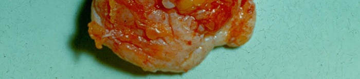 desmesothelialenGewebes1.jpg