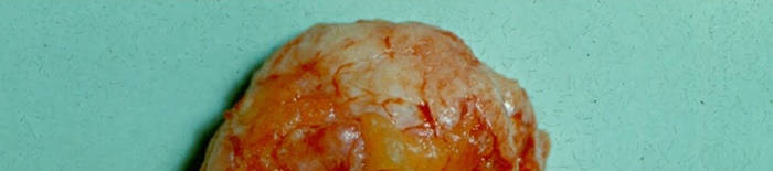 desmesothelialenGewebes1.jpg